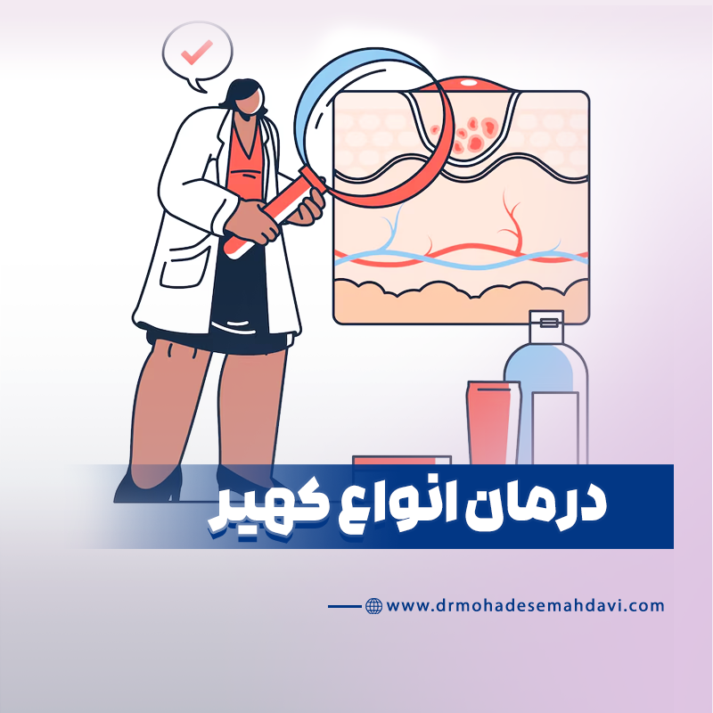 درمان آلرژی های تنفسی