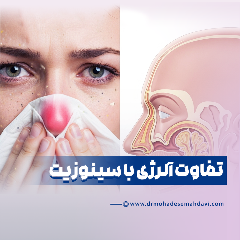 تفاوت آلرژی با سینوزیت چیست؟