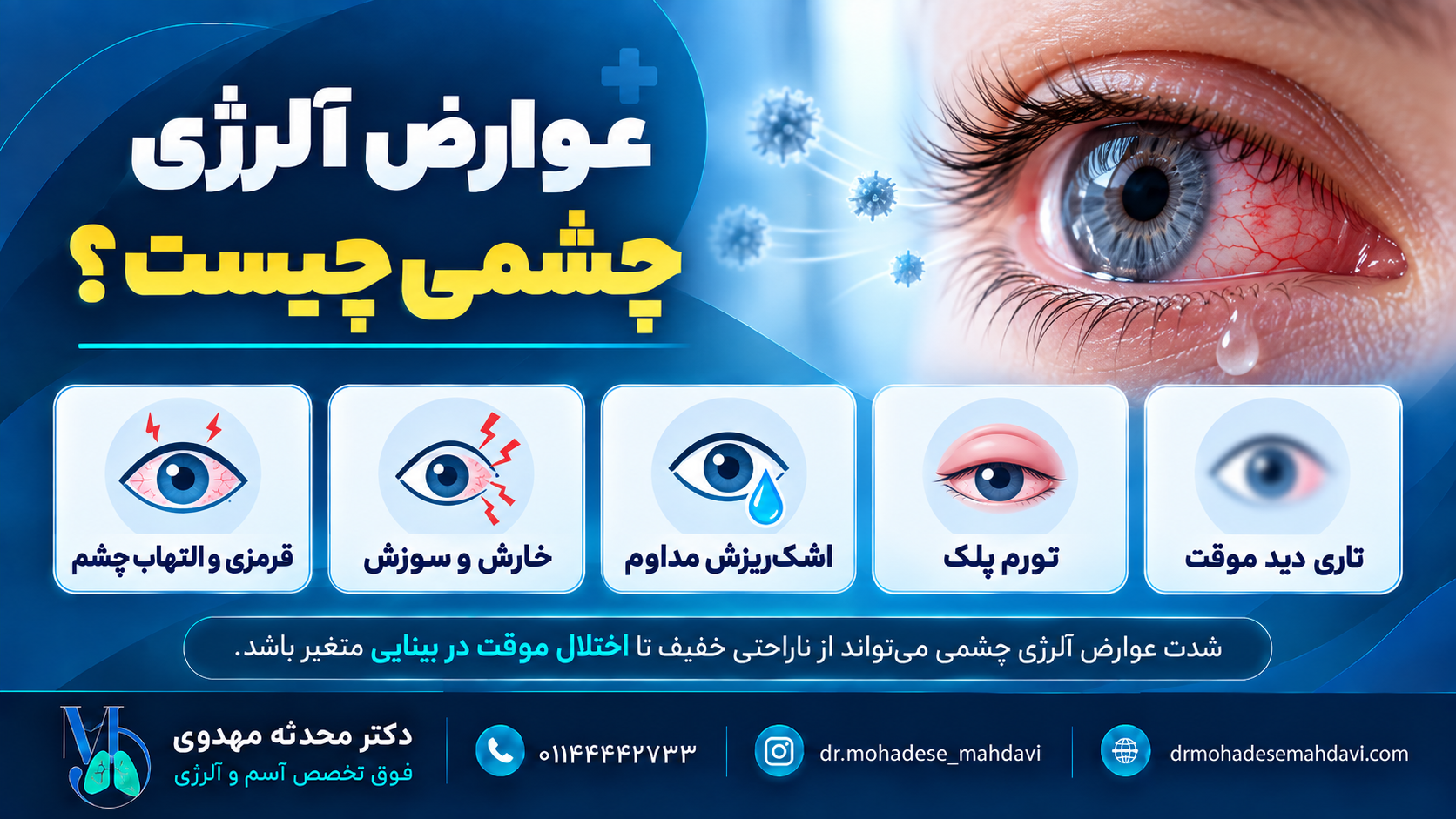 عوارض آلرژی چشمی چیست؟