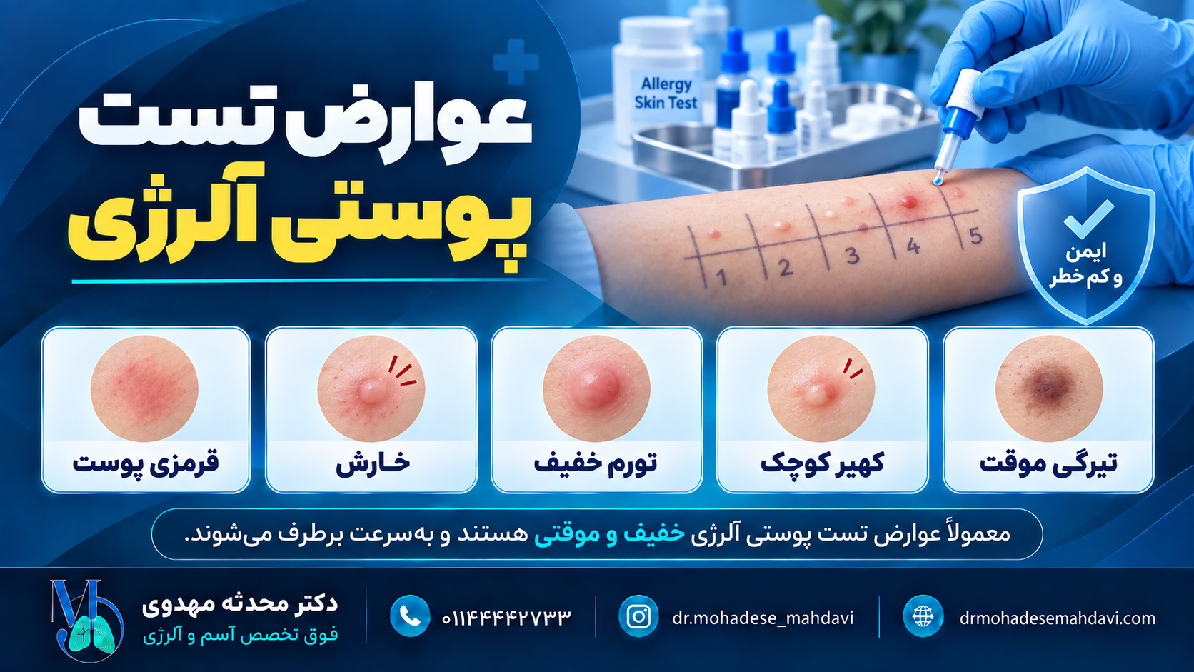 عوارض تست پوستی آلرژی