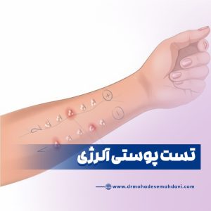 تست پوستی آلرژی