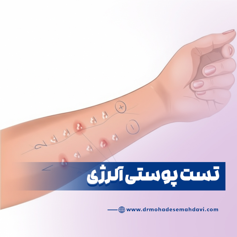 تست پوستی آلرژی